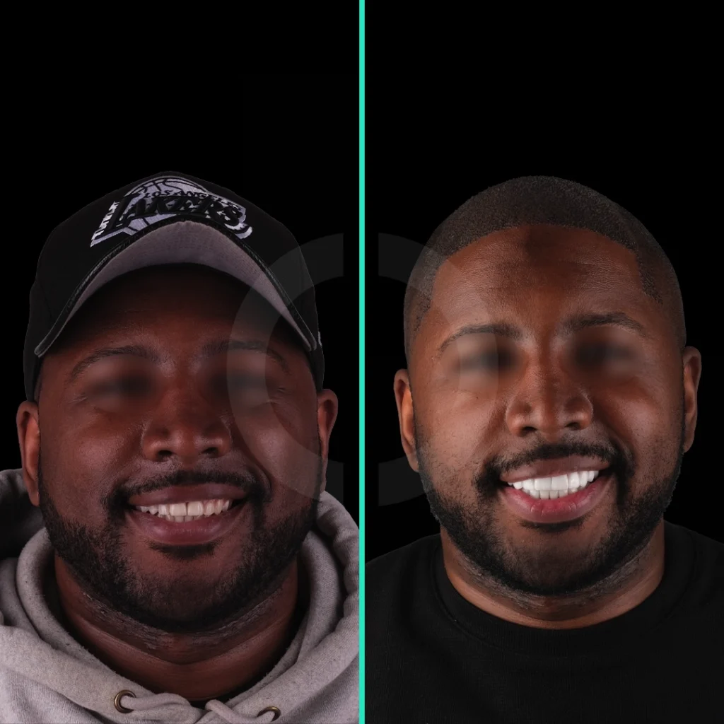 dental-aesthetics-before-after-1