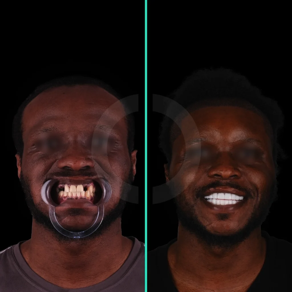 dental-aesthetics-before-after-3