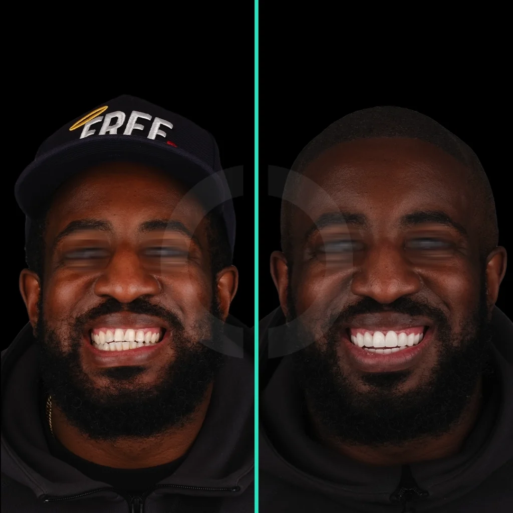 dental-aesthetics-before-after-4